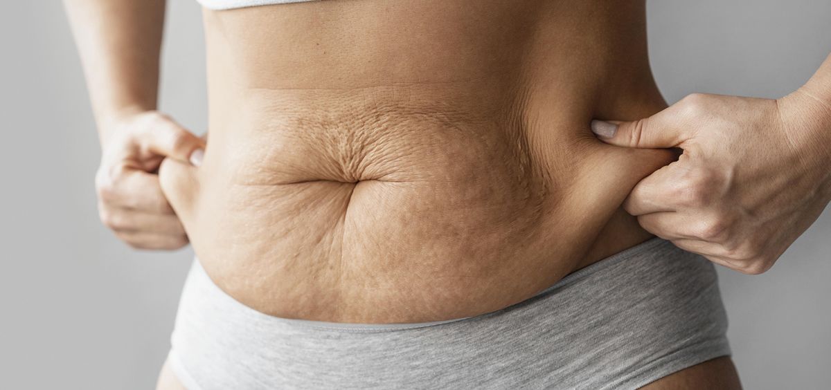 Cómo eliminar grasa localizada en el abdomen